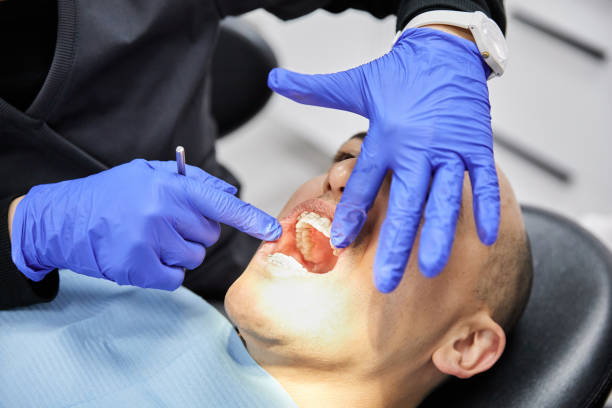 Best Chipped Tooth Repair Near Me  in East Whittier, CA